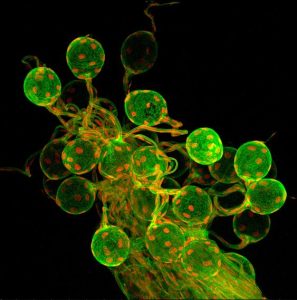 Protozoan Locomotion: Cilia, Flagella and Pseudopodia