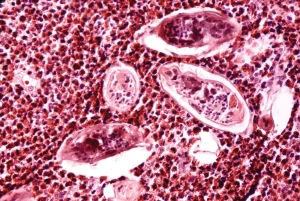 Schistosoma: Blood Flukes