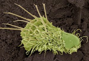 Phylum Gastrotricha
