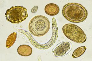 Phylum Acanthocephala: Form and Function